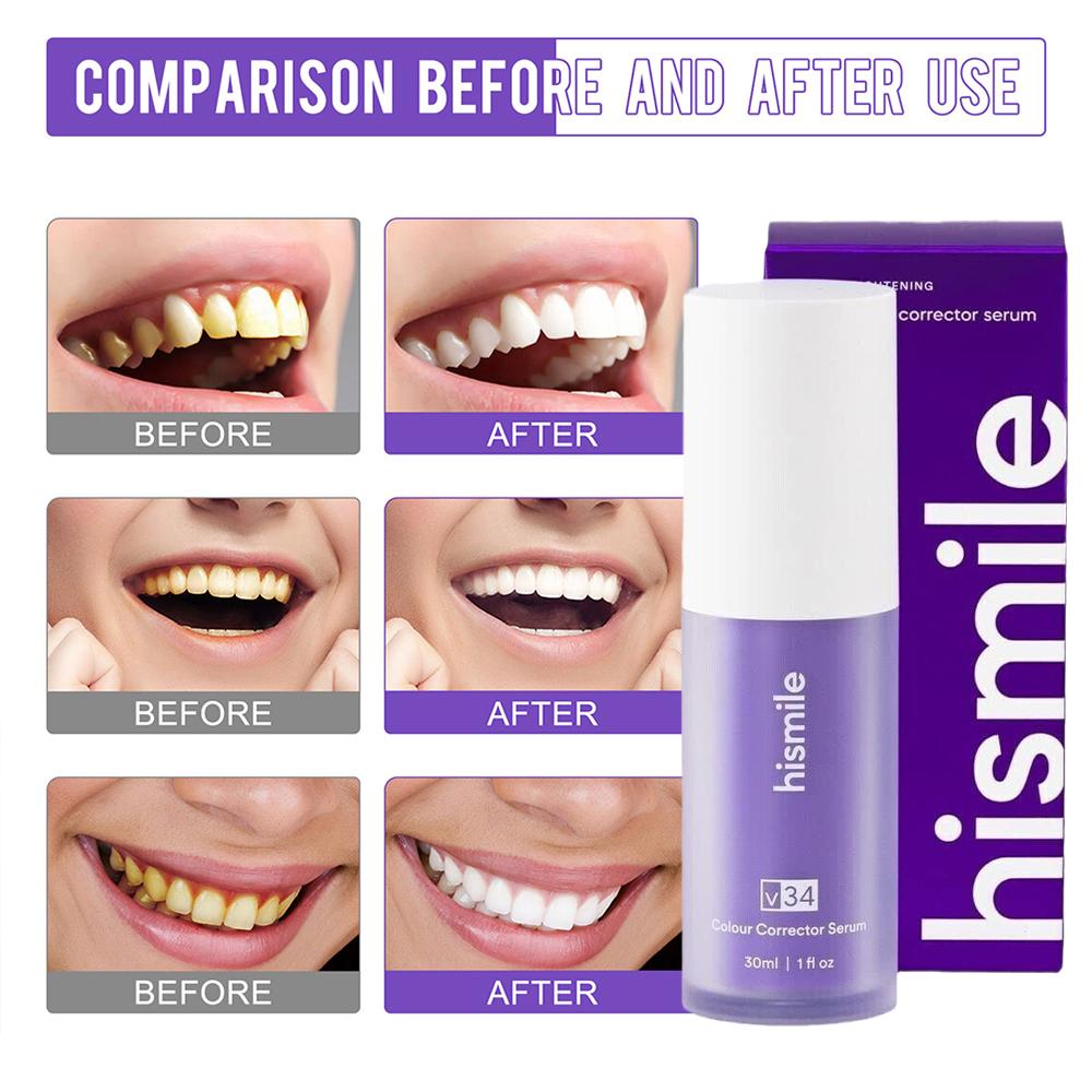 Hismile v34 Color Corrector